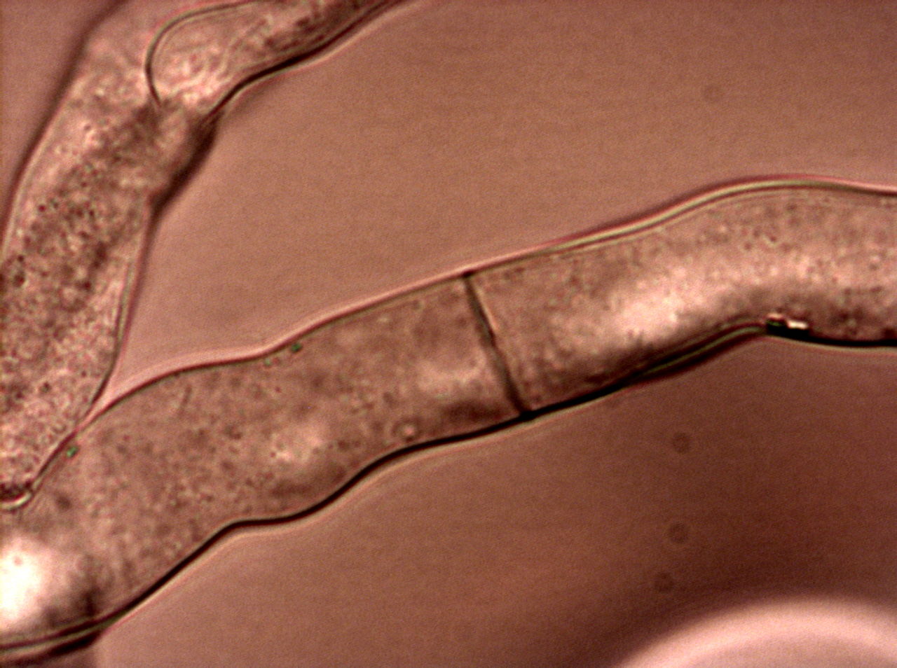 Neurospora Crassa Wikipedia