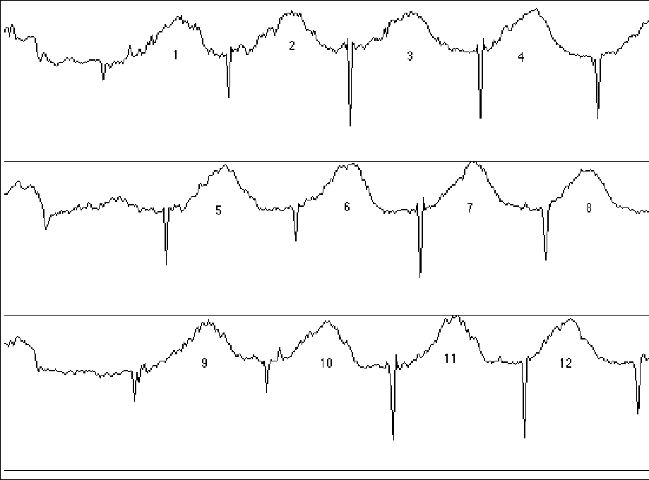 trace of optical density